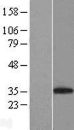 Novus Biologicals&trade;&nbsp;CD8 Overexpression Lysate