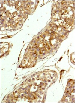 CD81 Antibody (1D6) - BSA Free, Novus Biologicals:Antibodies:Primary Antibodies