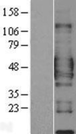 Novus Biologicals&trade;&nbsp;CD84/SLAMF5 Overexpression Lysate