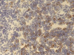 CD8 Antibody (53-6.7) - BSA Free, Novus Biologicals 0.5mg; Unlabeled:Antibodies,