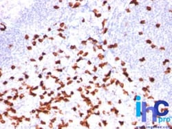 CD8 Antibody, Novus Biologicals:Antibodies:Primary Antibodies