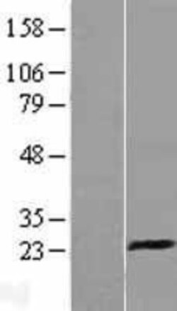 Novus Biologicals&trade;&nbsp;CD94 Overexpression Lysate