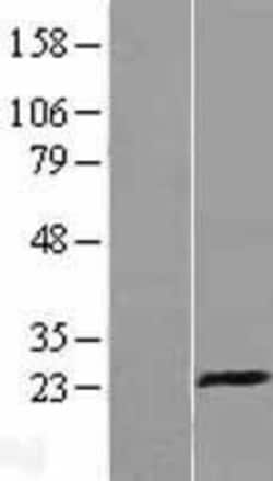 Novus Biologicals&trade;&nbsp;CD94 Overexpression Lysate