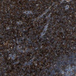 CD97 Antibody, Novus Biologicals 0.1mL; Unlabeled:Anticorps, Polyclonal