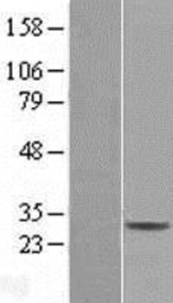 Novus Biologicals&trade;&nbsp;CD99-L2 Overexpression Lysate