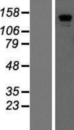 Novus Biologicals&trade;&nbsp;CDAN1 Overexpression Lysate
