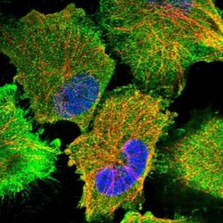 CDAN1 Antibody, Novus Biologicals:Antibodies:Primary Antibodies