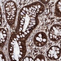 CDAN1 Antibody, Novus Biologicals:Antibodies:Primary Antibodies