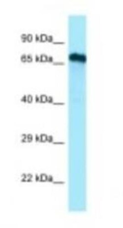 Cdc14A Antibody, Novus Biologicals 100μL; Unlabeled:Antibodies, Polyclonal