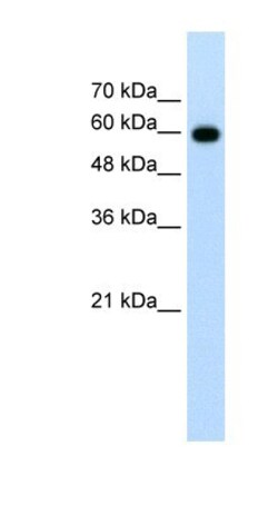 Cdc23 Antibody, Novus Biologicals 100&mu;L; Unlabeled:Antibodies, Polyclonal