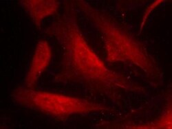 CDC25C, p Ser216 Antibody, Novus Biologicals 0.025 mL; Unconjugated:Antibodies,