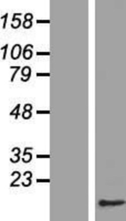Novus Biologicals™ CDC26 Overexpression Lysate