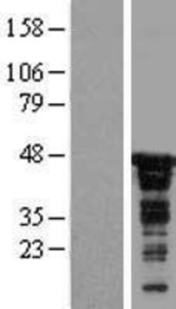 Novus Biologicals&trade;&nbsp;CDC37 Overexpression Lysate