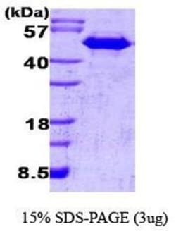 Novus Biologicals&trade;&nbsp;Recombinant Human CDC37 Protein