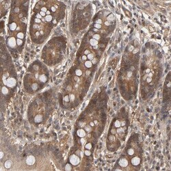 CDC37 Antibody, Novus Biologicals 0.1mL; Unlabeled:Antibodies, Polyclonal