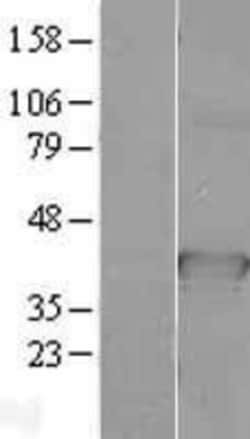 Novus Biologicals&trade;&nbsp;CDC37L1 Overexpression Lysate