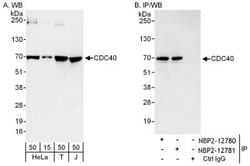 CDC40 Antibody, Novus Biologicals 0.1mg; Unlabeled:Antibodies, Polyclonal
