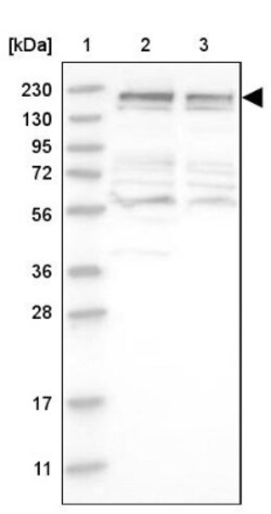 CDC42BPB Antibody, Novus Biologicals:Antibodies:Primary Antibodies