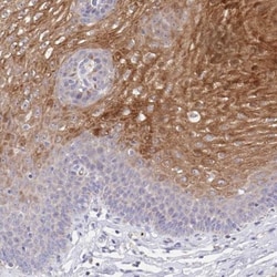 CDC42BPG Antibody, Novus Biologicals 0.1mL; Unlabeled:Antibodies, Polyclonal