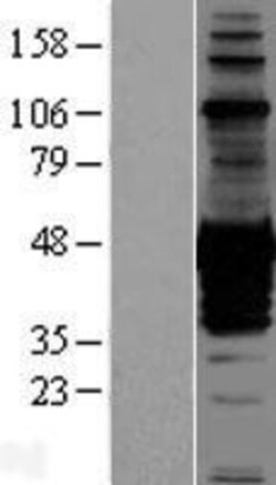 Novus Biologicals™ CDC42EP1 Overexpression Lysate