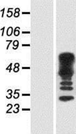 Novus Biologicals&trade;&nbsp;CDC42EP4 Overexpression Lysate