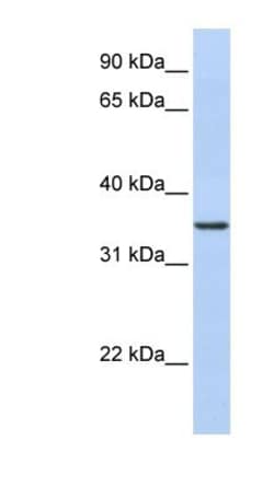 CDC42EP4 Antibody, Novus Biologicals 100 &mu;L | Buy Online | Novus Biologicals | Fisher Scientific