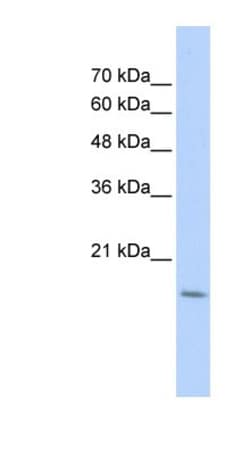 CDC42EP5 Antibody, Novus Biologicals:Antibodies:Primary Antibodies