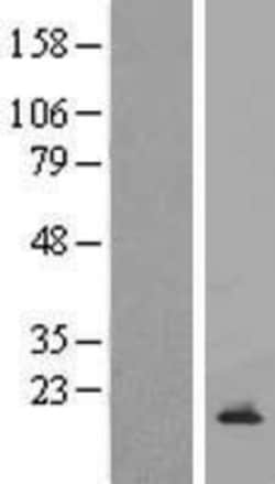 Novus Biologicals&trade;&nbsp;CDC42SE2 Overexpression Lysate