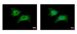 CDC45L Antibody, Novus Biologicals 0.1mL; Unlabeled:Antibodies, Polyclonal