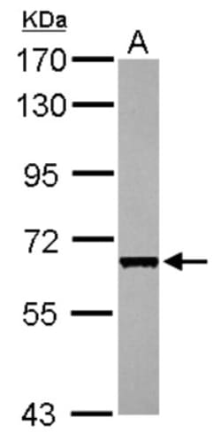 CDC45L Antibody, Novus Biologicals 0.1mL; Unlabeled:Antibodies, Polyclonal