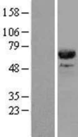 Novus Biologicals™ CDC45L Overexpression Lysate