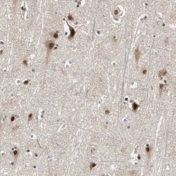 CDC5L Antibody, Novus Biologicals 0.1mL; Unlabeled:Antibodies, Polyclonal