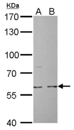 Cdc6 Antibody, Novus Biologicals 0.1mL; Unlabeled:Antibodies, Polyclonal