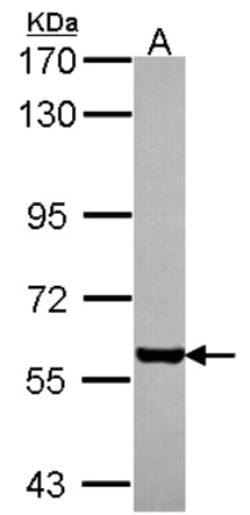 Cdc6 Antibody, Novus Biologicals 0.1mL; Unlabeled:Antibodies, Polyclonal