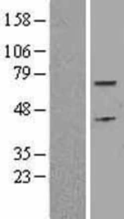 Novus Biologicals&trade;&nbsp;Cdc6 Overexpression Lysate