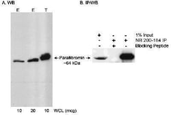 CDC73/HRPT2 Antibody, Novus Biologicals 0.1mg; Unlabeled:Antibodies, Polyclonal