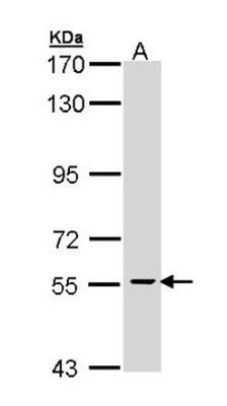 CDC73/HRPT2 Antibody, Novus Biologicals 0.1mL; Unlabeled:Antibodies, Polyclonal