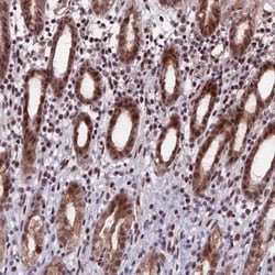 CDC7 Antibody, Novus Biologicals:Antibodies:Primary Antibodies