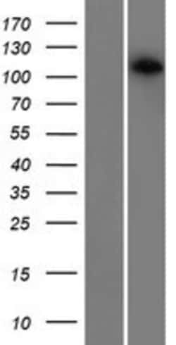 Novus Biologicals&trade;&nbsp;CDCA2 Overexpression Lysate