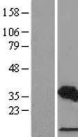 Novus Biologicals&trade;&nbsp;CDCA3 Overexpression Lysate