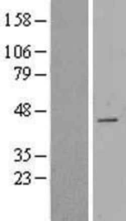 Novus Biologicals&trade;&nbsp;CDCA7 Overexpression Lysate