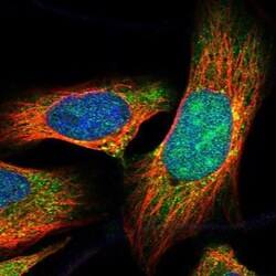 CDCA7L Antibody, Novus Biologicals 0.1mL; Unlabeled:Antibodies, Polyclonal