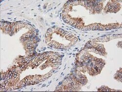 CDCP1 Antibody (OTI2C1), Novus Biologicals 0.1 mL | Buy Online | Novus Biologicals | Fisher Scientific