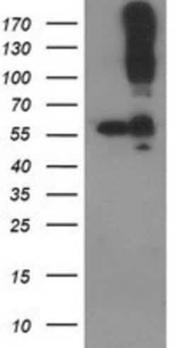 CDCP1 Antibody (OTI2C1), Novus Biologicals 0.1 mL | Buy Online | Novus Biologicals | Fisher Scientific