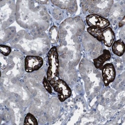 Cadherin-22 Antibody, Novus Biologicals 25 &mu;L; Unlabeled:Antibodies,