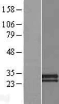 Novus Biologicals&trade;&nbsp;CDHR4 Overexpression Lysate