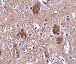 CDIP Antibody - BSA Free, Novus Biologicals 0.025 mg, Unconjugated:Antibodies,