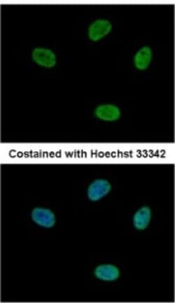 CDK10 Antibody, Novus Biologicals 0.1mL; Unlabeled:Antibodies, Polyclonal