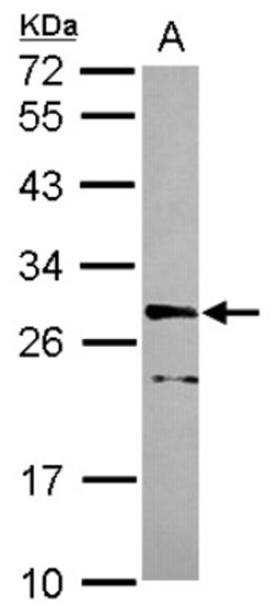 CDK10 Antibody, Novus Biologicals 0.1mL; Unlabeled:Antibodies, Polyclonal