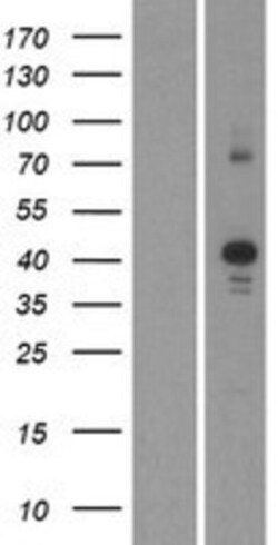 Novus Biologicals&trade;&nbsp;CDK10 Overexpression Lysate